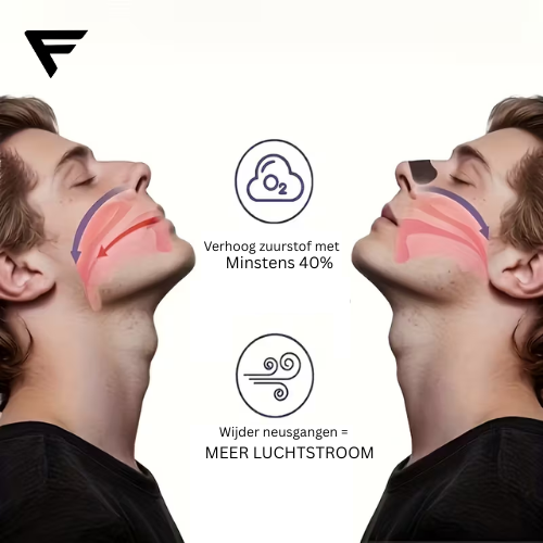 FITURNUS™ AirFlow Nasal Strips
